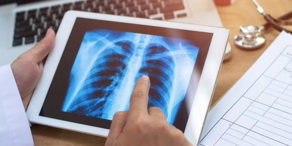 health care chest scan