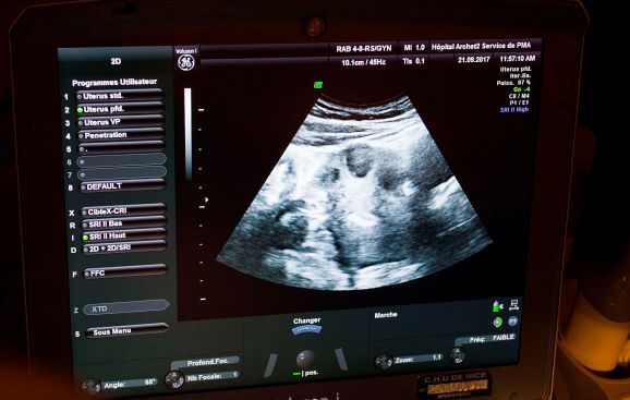 Ultrasound in action